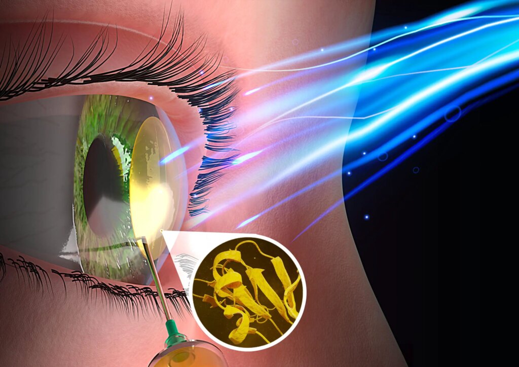 Therapeutic Energy of Light_ Biomimetic Supplies Pulsed With Low-Vitality Blue Mild Can Reshape Broken Corneas